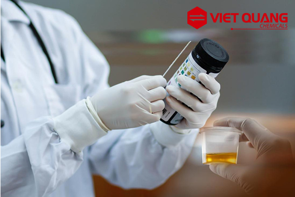 Dung môi Acetone ứng dụng trong phòng thí nghiệm