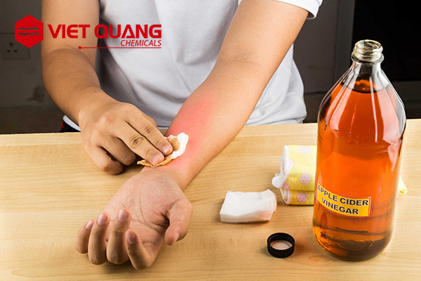 Butyl acetate có độc không