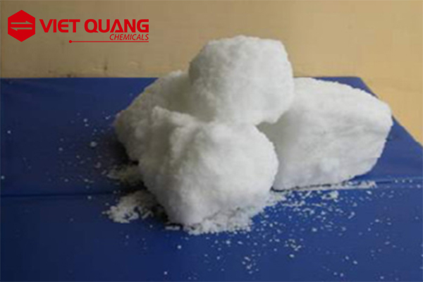 dạm ure bi ket khoi